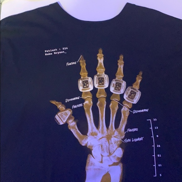 kobe x ray t shirt